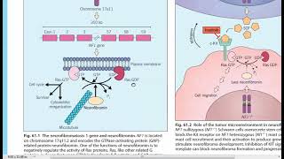 5 Neurofibromatosis and Tuberous sclerosis by Dr Ahmed Anany [upl. by Devi]