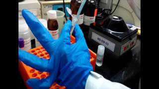 Alkaline Hemoglobin Electrophoresis Demonstration  HiMedia Laboratories [upl. by Selie]