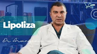 Sve što treba da znate o lipolizi  Dr Vladimir Arsenijević [upl. by Aicella]