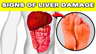 12 Warning Weird Signs That Show You Are Having Liver Damage [upl. by Enyamrahs17]