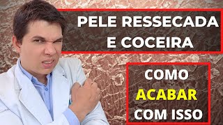 COCEIRA E PELE RESSECADA Como acabar com isso DICAS PARA PELE SECA [upl. by Urba]