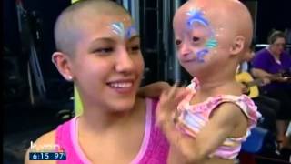 Adalia Rose holds fundraiser for Progeria [upl. by Anazus110]