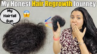 My Hair Loss amp Hair Regrowth Journey  Sharing My Story❤️ [upl. by Annaohj429]