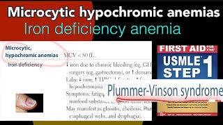 Microcytic hypochromic anemias Iron deficiency anemia PlummerVinson syndrome in HindiUrdu USMLE [upl. by Yurt]