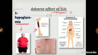 Oral antidiabetic drugs 1 [upl. by Lilithe429]