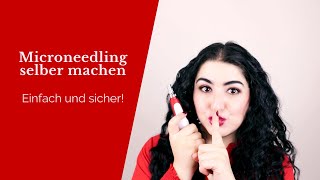 Microneedling selber machen ⎮ Einfach schmerzfrei und sicher [upl. by Johny]