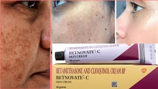 Betnovate C Cream HONEST review 2024 In Hindi  How To Use Betnovate C Cream [upl. by Putnem246]