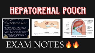 Hepatorenal Pouch under 7 minutes🔥🔥 ABDOMEN ANATOMY [upl. by Rramaj]