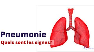 PNEUMONIE QUELS SONT LES SYMPTÔMES D´ALERTE [upl. by Court]