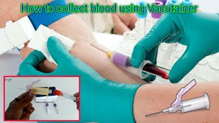 How to collect blood using Vacutainer  Vacutainer Blood Collection Procedure  Blood Test Procedure [upl. by Sillek]