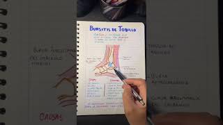 Bursitis de tobillo [upl. by Aronel]