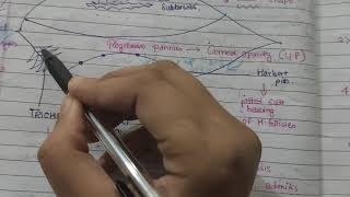 Trachoma diseases of conjunctivatheory notes with explanation AK KHURANA [upl. by Artenak]