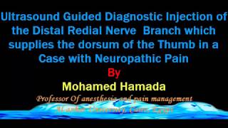 ultrasound Guided Diagnostic Injection to the Distal Radial Nerve Branch [upl. by France838]