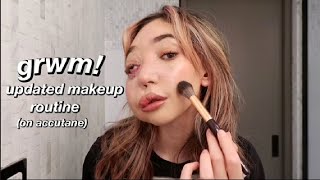 my everyday makeup routine 2023 with acne while on accutane [upl. by Nolek]