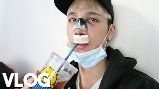 Getting Rhinoplasty in Gangnam  Vlog  Edward Avila [upl. by Adnyc]