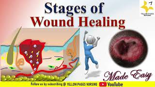 The Science of Wound Healing  Part 1 [upl. by Gnurt]