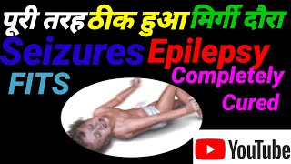 Seizures epilepsy Completely Cured [upl. by Mloclam]