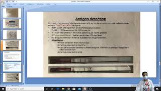 lab diagnosis of filariasis [upl. by Allesiram]