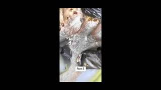 Treating real zombie feet 👣 footpain fyp viralvideo satisfying callusremovale crackedfeet [upl. by Assiran]