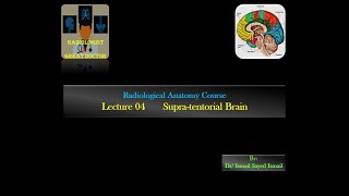 Radiological Anatomy Course Lecture 04 Brain Supratentorial Part3 [upl. by Naraa]