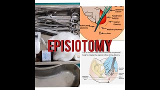 EPISIOTOMY EPISIOTOMY TRAYINSTRUMENTEASY EXPLANATIONSUSES [upl. by Phedra]