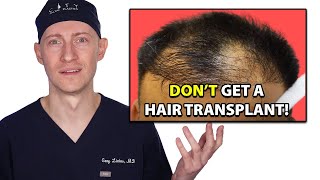 10 Reasons  Do Not Get A Hair Transplant  Hair Surgeon Reacts [upl. by Bikales293]