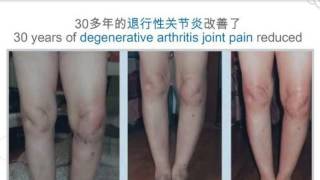 Ageloc R2 Before amp After Testimonial [upl. by Lehcim]