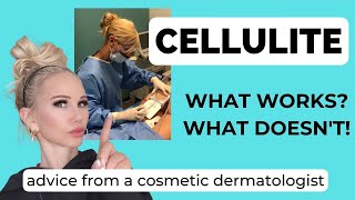 6 Tips to Get Rid of Cellulite  Dr Janine [upl. by Leonid922]