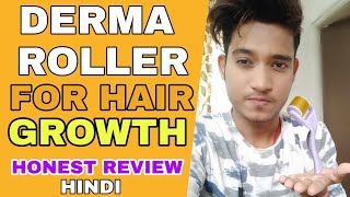 Derma Roller For Hair Growth   Hindi  Does Derma Roller Really Work For Hair Loss  Honest Review [upl. by Cirillo]