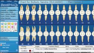 Mastering Charting in Dental Software Pt 1  DentiMax Webinar [upl. by Kartis621]