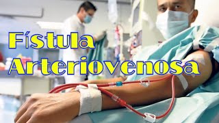 Fístula Arteriovenosa para hemodiálisis [upl. by Jenifer]