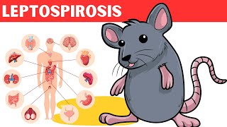 Leptospirosis  Causes Risk Factors Pathology Signs amp Symptoms Diagnosis And Treatment [upl. by Enelam327]