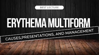 Erythema multiform  Erythema multiform lecture  Oral medicine lecture [upl. by Agata634]