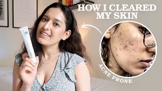 My 3 Step EvidenceBased Skincare Routine As A Doctor  HOW I CLEARED MY ACNE  Affordable Easy [upl. by Atener]