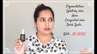 SESDERMA AZELAC RU Liposomal Serum TRX Review  Hindi [upl. by Airotna]