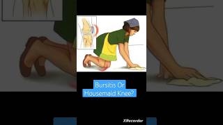 Bursitis Or Housemaid Knee Anatomy Lower Limb [upl. by Dewhirst]