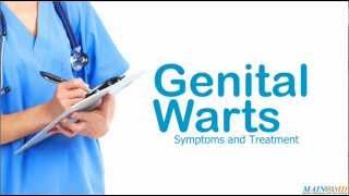 Genital Warts ¦ Treatment and Symptoms [upl. by Dionne]