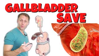 How to Save a Gallbladder and Get Rid of Gallstones [upl. by Silber]