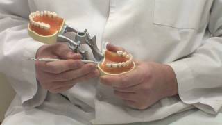 Dental Gold  Advantages of Gold Dental Fillings [upl. by Peri754]