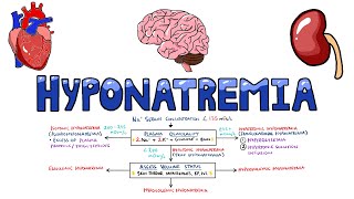 An Approach to Hyponatremia  Hyponatremia Diagnostic Algorithm  Hyponatremia Causes MADE EASY [upl. by Ali76]