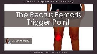 The Rectus Femoris Trigger Point [upl. by Narruc]