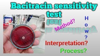 Bacitracin Sensitivity Test Microbiology [upl. by Retla]