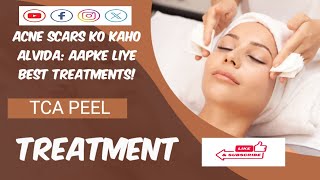 DRAMATIC CHEMICAL PEEL  Phenol Peel For Acne Scars shorts [upl. by Yelkao]