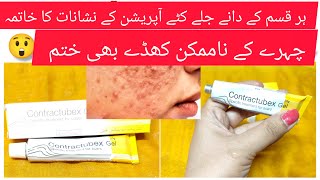 iss Gel Ne Kya Kar Diya😭😭😭😱youtube skincare skincareroutine [upl. by Triny]