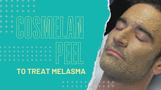 Cosmelan Peel to Treat Melasma  Dr Jason Emer [upl. by Younglove]