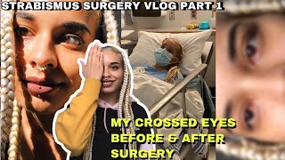 strabismus surgery vlog part 1 preparation amp surgery day  eye muscle surgery before and after [upl. by Aroz]