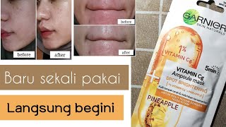 REVIEW GARNIER VITAMIN AMPOULE SHEET MASK SPOT BRIGHTENING  BIKIN CERAH amp NODA HITAM TERSAMARKAN [upl. by Emmeline]