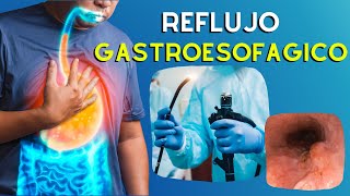 🔥 ERGE Causas Diagnostico y Tratamiento de la Enfermedad por Reflujo Gastroesofágico  Podcast [upl. by Ahdar]