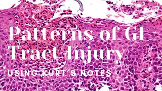 Patterns of GI Tract Injury Kurt’s Notes pathagonia [upl. by Ulphi]