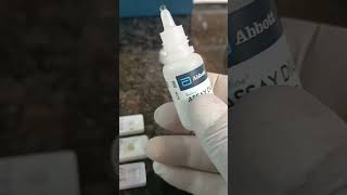 HIV HCV HBSAG Test Procedure by Kit laboratory pathology medicallaboratory lab labtechdt [upl. by Areik]